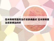 佳木斯哪家医院治疗皮肤病最好 佳木斯哪里治皮肤病治的好