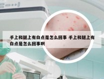 手上和腿上有白点是怎么回事 手上和腿上有白点是怎么回事啊