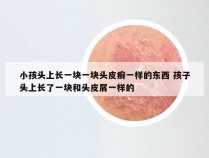 小孩头上长一块一块头皮癣一样的东西 孩子头上长了一块和头皮屑一样的