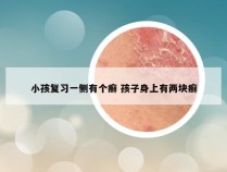 小孩复习一侧有个癣 孩子身上有两块癣