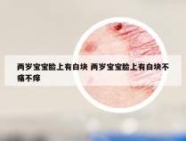 两岁宝宝脸上有白块 两岁宝宝脸上有白块不痛不痒