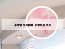 手掌有白点图片 手掌出现白点