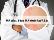 银屑病伤口不愈合 银屑病皮肤伤口不愈合