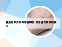 甘肃省牛皮癣专家有哪些 甘肃省皮肤病研究所