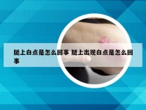 腿上白点是怎么回事 腿上出现白点是怎么回事