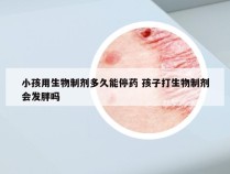 小孩用生物制剂多久能停药 孩子打生物制剂会发胖吗