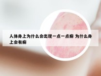 人体身上为什么会出现一点一点癣 为什么身上会有癣