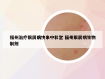 福州治疗银屑病快来中和堂 福州银屑病生物制剂