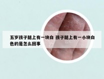 五岁孩子腿上有一块白 孩子腿上有一小块白色的是怎么回事