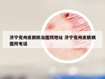 济宁兖州皮肤防治医院地址 济宁兖州皮肤病医院电话