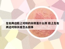 左右两边脸上对称的白斑是什么斑 脸上左右两边对称长痘怎么回事