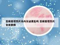 百癣夏塔热片会内分泌紊乱吗 百癣夏塔热片会皮肤痒