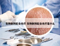 生物制剂配合光疗 生物制剂配合光疗是什么