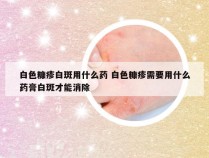 白色糠疹白斑用什么药 白色糠疹需要用什么药膏白斑才能消除