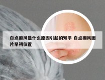 白点癫风是什么原因引起的知乎 白点癫风图片早初位置