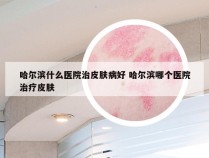 哈尔滨什么医院治皮肤病好 哈尔滨哪个医院治疗皮肤