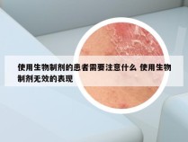 使用生物制剂的患者需要注意什么 使用生物制剂无效的表现