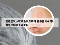 藿香正气水可以治头皮癣吗 藿香正气水可以治头皮癣吗有效果吗