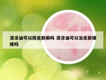 清凉油可以擦皮肤癣吗 清凉油可以治皮肤瘙痒吗