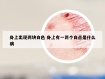 身上出现两块白色 身上有一两个白点是什么病