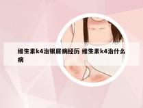 维生素k4治银屑病经历 维生素k4治什么病