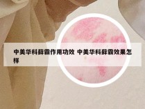 中美华科藓霸作用功效 中美华科藓霸效果怎样