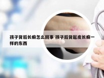 孩子背后长癣怎么回事 孩子后背起皮长癣一样的东西