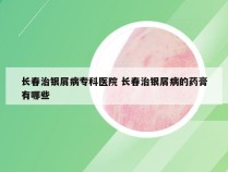 长春治银屑病专科医院 长春治银屑病的药膏有哪些