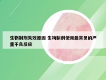 生物制剂失效原因 生物制剂使用最常见的严重不良反应