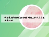 嘴唇上的白点点怎么去除 嘴唇上的白点点怎么去除掉