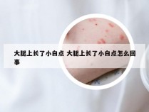 大腿上长了小白点 大腿上长了小白点怎么回事