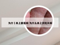 为什麼身上都是癣 为什么身上到处长癣