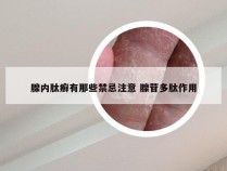 腺内肽癣有那些禁忌注意 腺苷多肽作用