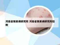 河南省银屑病研究院 河南省银屑病研究院招聘