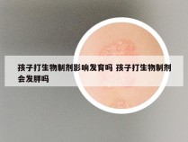 孩子打生物制剂影响发育吗 孩子打生物制剂会发胖吗