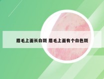 眉毛上面长白斑 眉毛上面有个白色斑