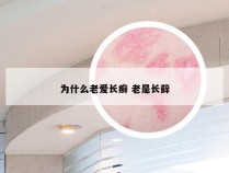 为什么老爱长癣 老是长藓