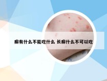 癣有什么不能吃什么 长癣什么不可以吃