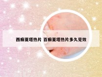 西癣夏塔热片 百癣夏塔热片多久见效