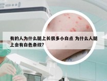 有的人为什么腿上长很多小白点 为什么人腿上会有白色条纹?