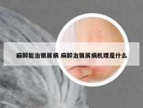 麻醉能治银屑病 麻醉治银屑病机理是什么