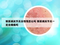 银屑病关节炎会慢慢恶化吗 银屑病关节炎一定会瘫痪吗