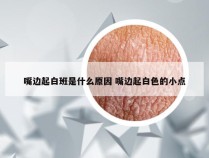 嘴边起白班是什么原因 嘴边起白色的小点