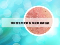 银屑病治疗说明书 银屑病用药指南