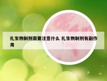 扎生物制剂需要注意什么 扎生物制剂有副作用