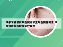 成都专业银屑病医院哪家正规医院在哪里 成都银屑病医院哪家效果好