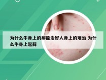 为什么牛身上的癣能治好人身上的难治 为什么牛身上起藓