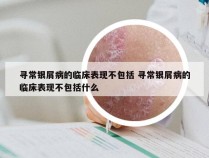 寻常银屑病的临床表现不包括 寻常银屑病的临床表现不包括什么