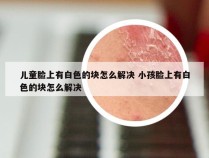 儿童脸上有白色的块怎么解决 小孩脸上有白色的块怎么解决