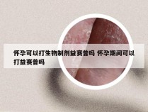 怀孕可以打生物制剂益赛普吗 怀孕期间可以打益赛普吗